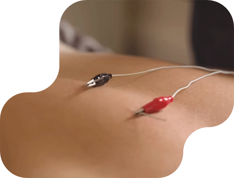 tratamiento con electroestimulación y vacumterapia en Valladolid